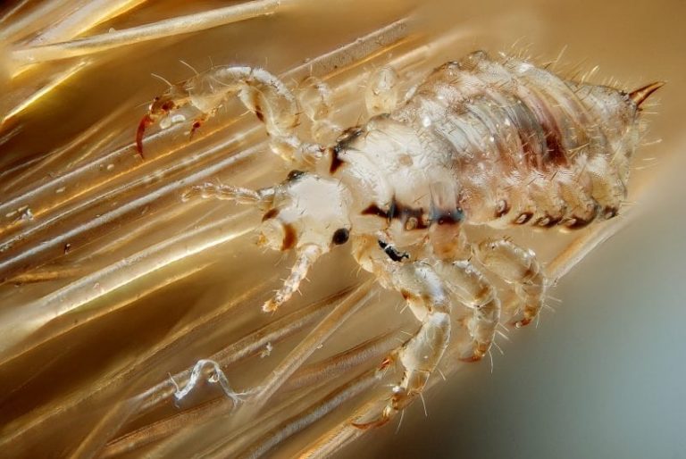 What Do Lice Look Like? Science Trends