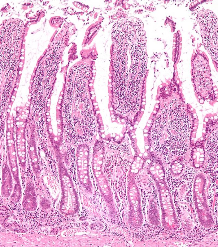 Small Intestine Function: Duodenum, Jejunum And Ileum - Science Trends